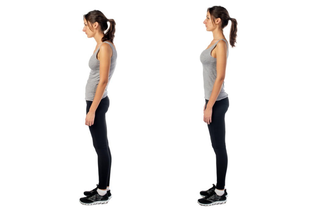 Exercises for Hyperextended Knees - Posture Direct