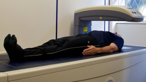 DXA scan for osteoporosis